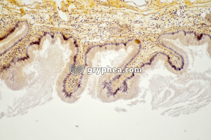 Oesophage Chien x40 - gryphea.org
